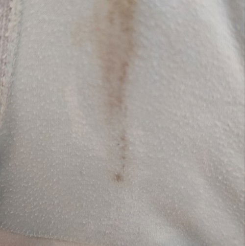 Brown discharge po ba ito?