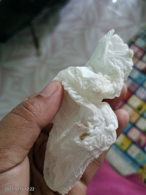 Bunda bantu sharingnya bun, hari ini ada sedikit flek keluar dari miss v, usia kehamilan 40w.