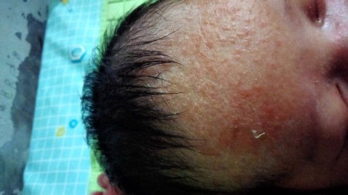 Putih putih dikepala