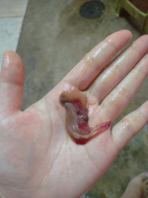 แบบนี้คืออะไรคะแม่ๆ