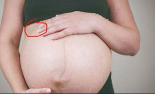 sakit perut di sebelah kanan atas