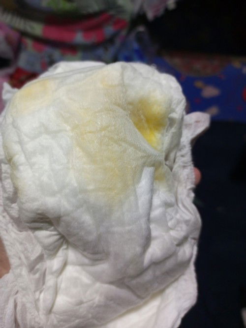 Mga mommies ask lang po