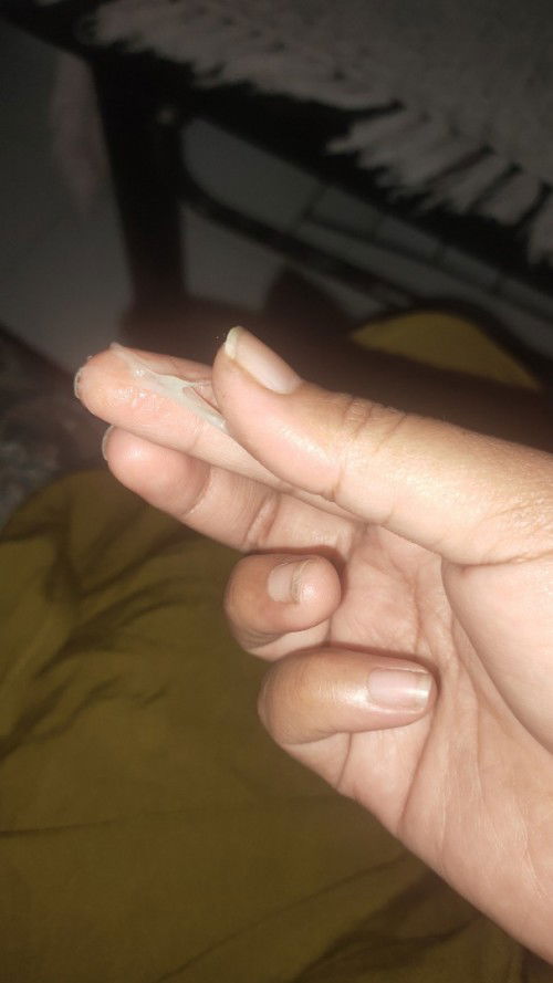 Keputihan atau gimana bun hamil 36w3d