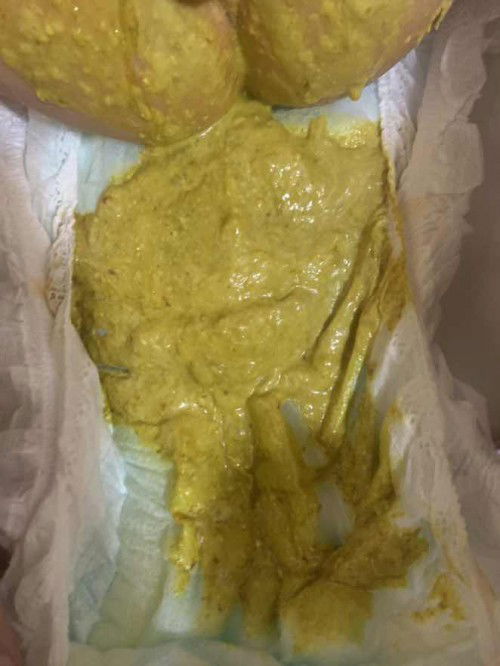 Poop of baby