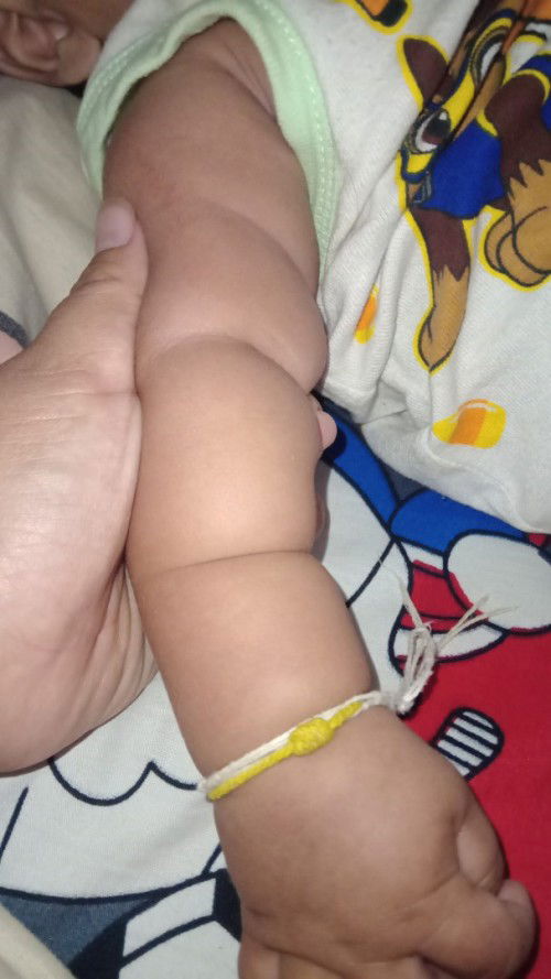 แขนเป็นป้อมๆ