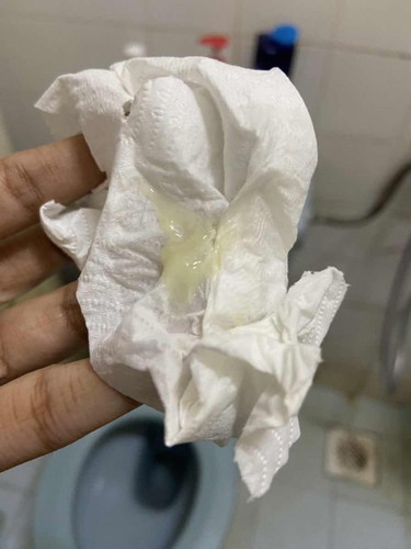 Ni mucus plug ke?