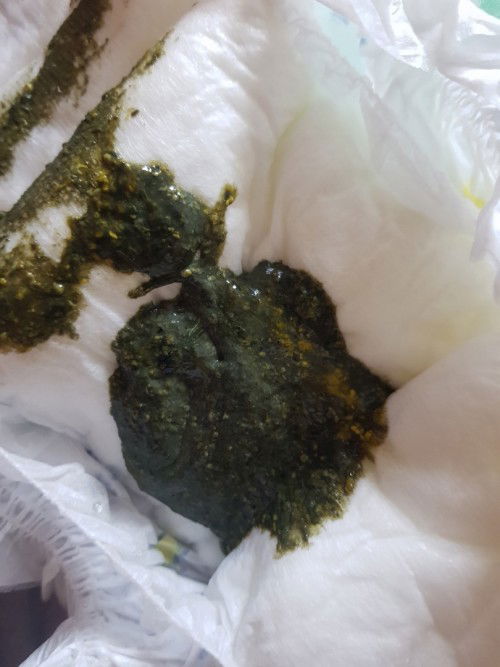 Pasintabi po . 
 Normal lang po ba na ganito kulay ng poops ni baby ko? formula po milk nya NAN OPTI