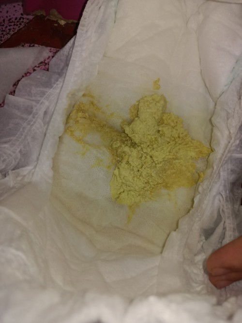 kulay ng poop pag nagiipin