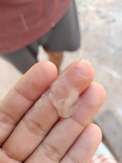 มูกใสหรือตกขาว ต่างกันยังไง