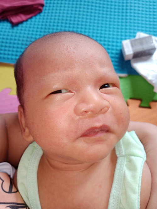 baby acne po ba ito o rashes? sabi po kasi ng pedia namin, dahil sa hangin thanks po!!!