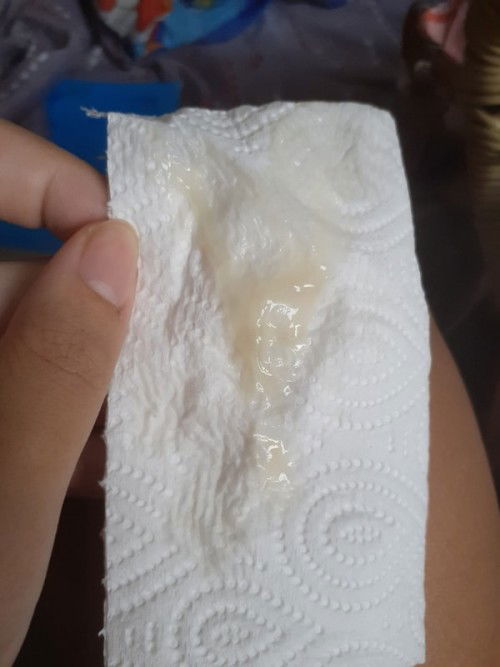 เมื่อวานเจ็บท้อง ปากมดลูกเปิดเซ็นเดียว วันนี้16:36มีมูกใสไหลออกมา