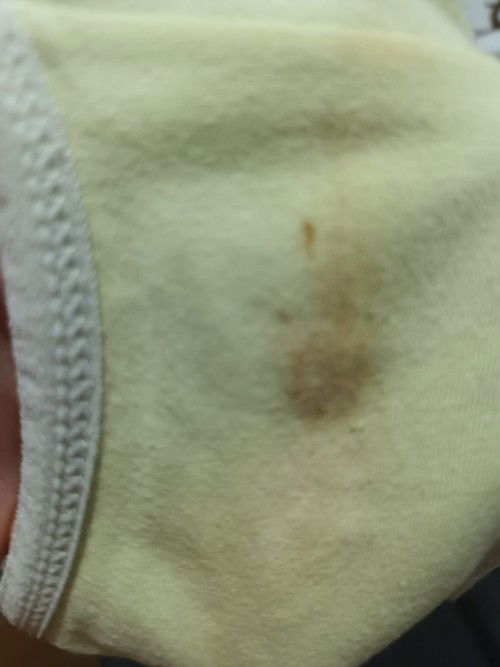 11 weeks no subchorionic bleeding