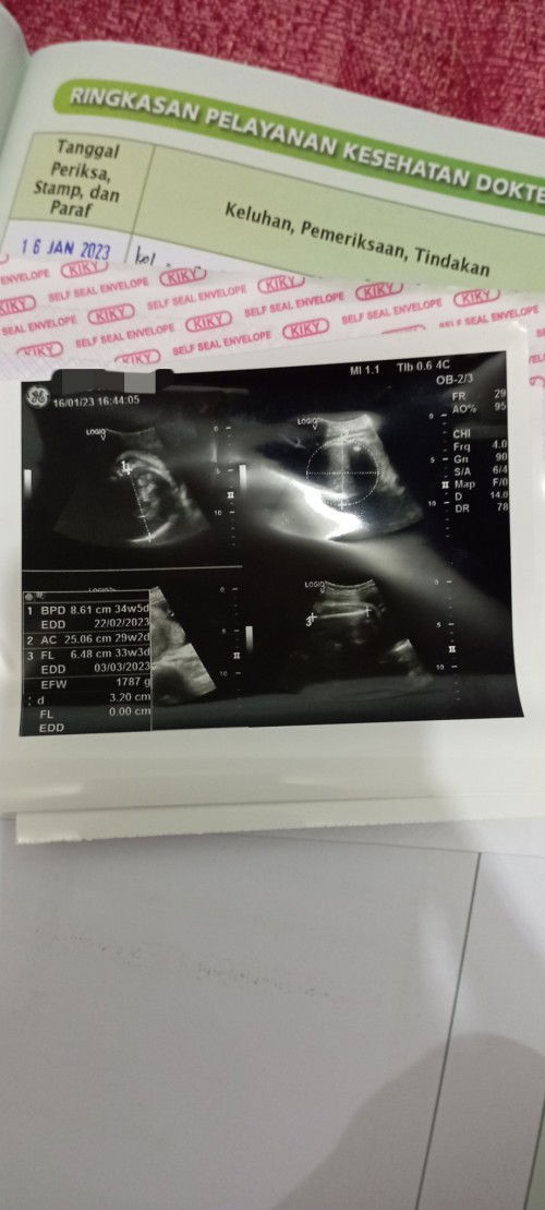 Ketuban cenderung sedikit