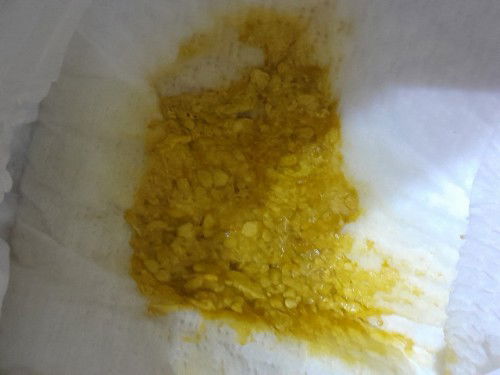 แบบนี้ผิดปกติมั้ยคะ