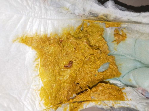 Najis agak pekat dan lendir berdarah