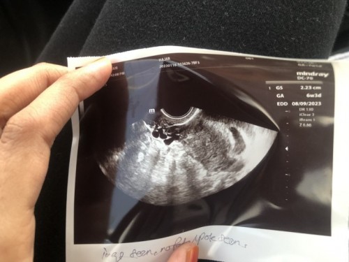 6week kantung kosong by TVS , kantung xnampak bulat