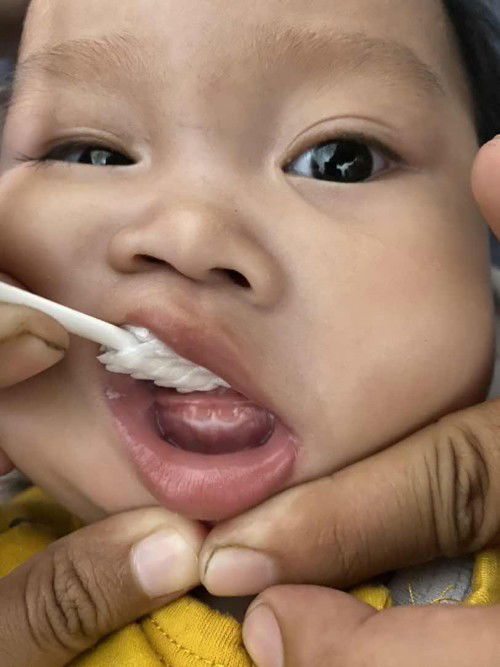 Ciri-ciri bayi Tumgi