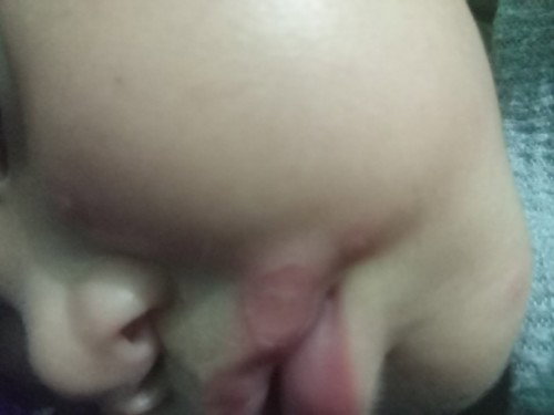 Ada yg tau obatnya apa