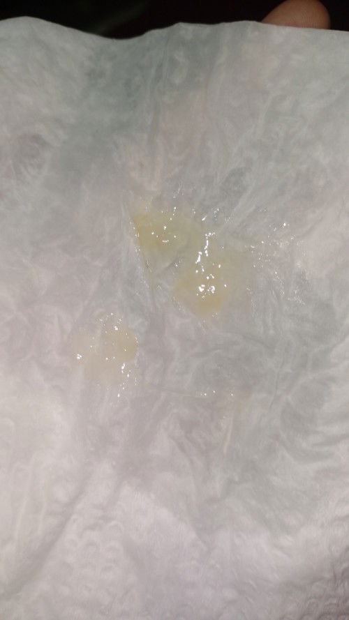 Kluar lendir mcm ni...tnda bsalin ke..x de rsa sakit lg..cuma kuar lendir je