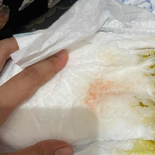 Pup bayi ada warna oren