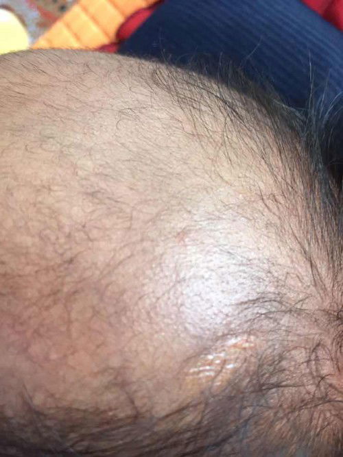 Bayi umur 1 bulan rontok dibagian depan wajar ga si?