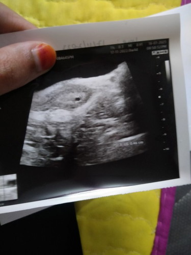Should be 8 weeks 4 days , tapi semalam scan hanya nampak kangung kecik je 😢 It normal mommy?