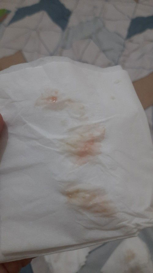 Bun ada yg keputihan seperti ini ketika 36wk?