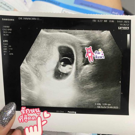 บันทึกลูกรัก 🥰