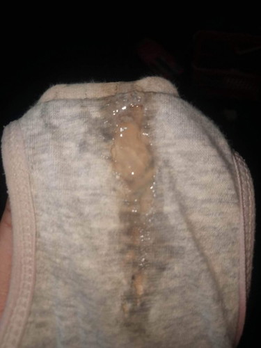 Mucus plug na po ba ito?
38 weeks na po tyan ko..