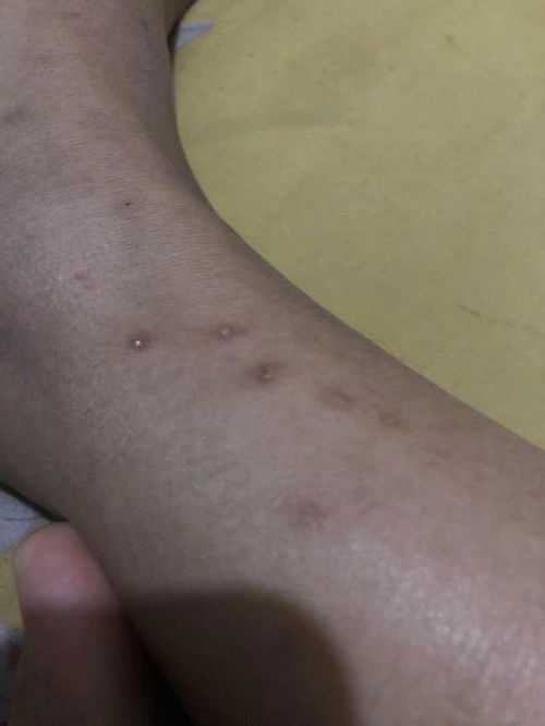 Gatal hampir seluruh badan saat hamil