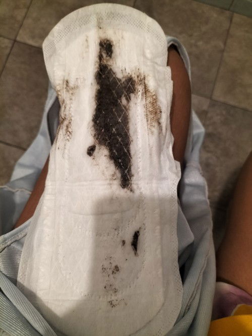 ประสบการณ์ตกเลือด