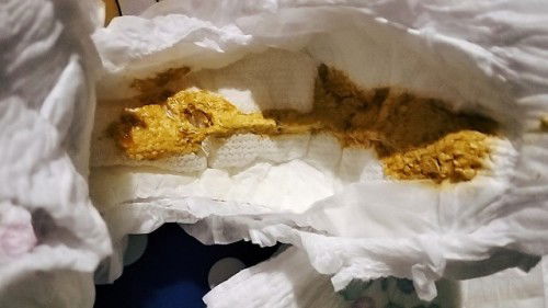 Bé tước lật phải ko ạ