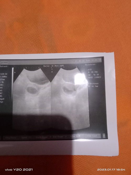 Mau tanya dong pengalamannya bunda🙏🙏🥺🥺