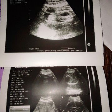 Ano po sa tingin niu mga mhie?baby girl po ba talaga ang baby ko?🥰