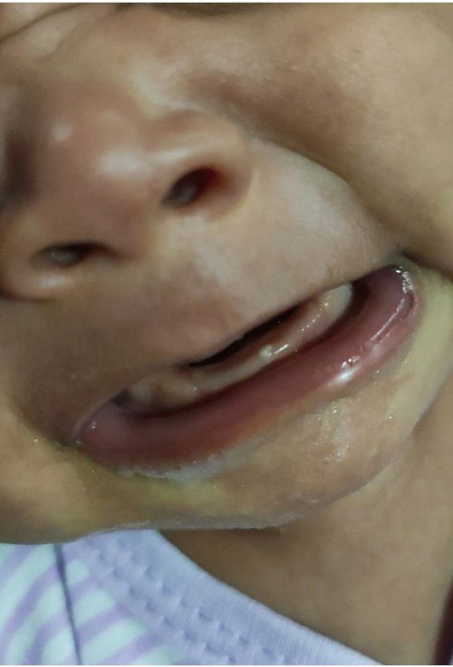 Gigi (bayi umur sebulan)