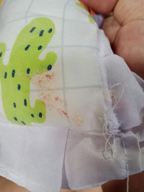 Lungad na my kasamang parang dugo