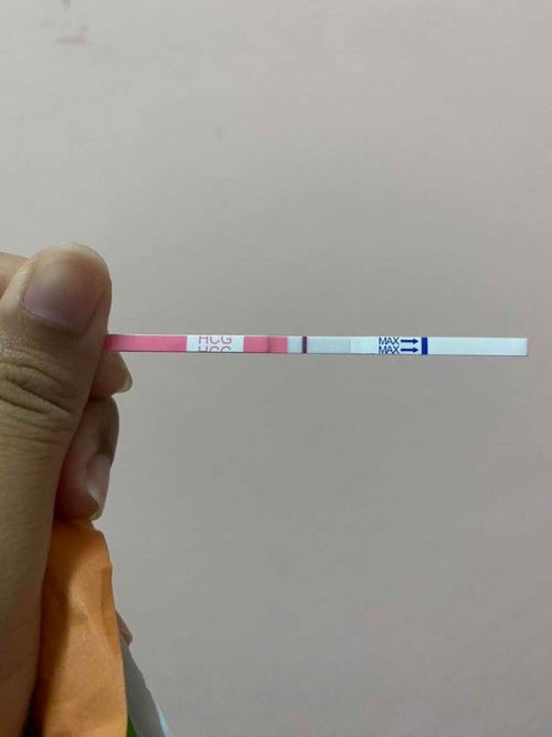 ประจำเดือนขาด