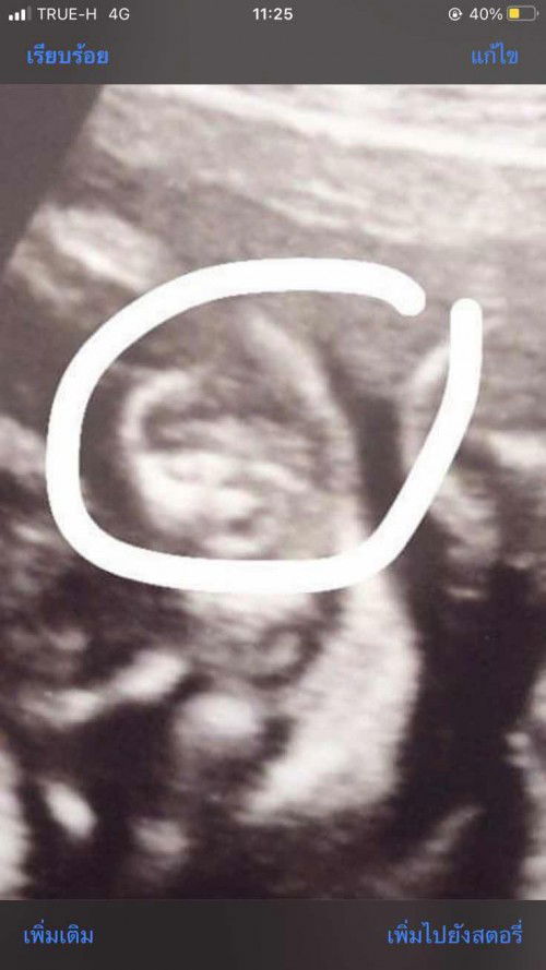 ช่วยด้วยค่ะแม่ๆๆ