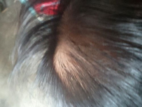 Benjolan dikepala bayi baru lahir lunak lama2 mengecil tapi keras