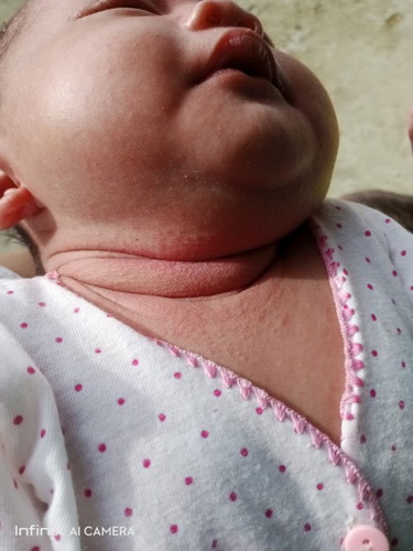 Leher bayi