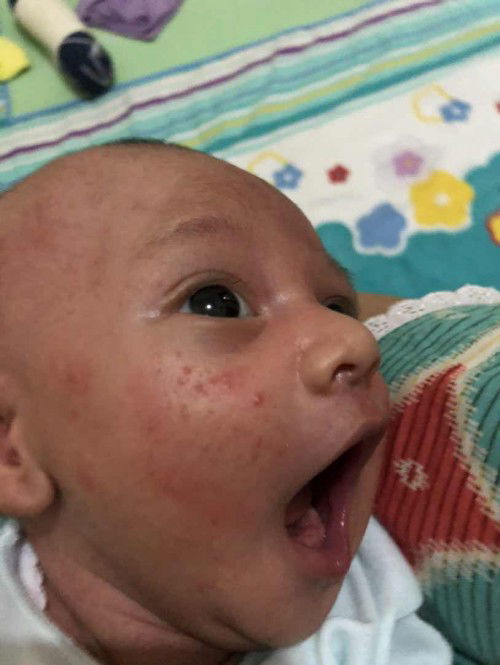 Bintik merah di wajah