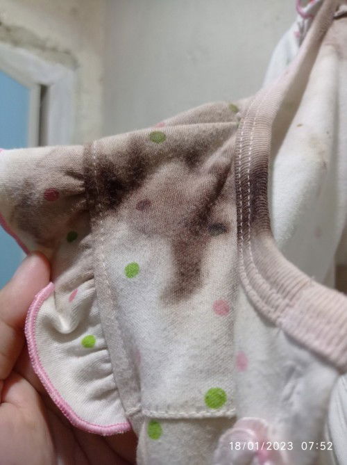 Noda bekas muntahan obat bayi