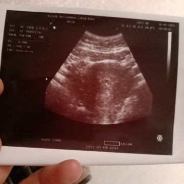 Assalamulaikum ibu2. ada sesiapa pernah alami mslh mcm sy tak.buntu 6w 1d tapi saiz masih kecil