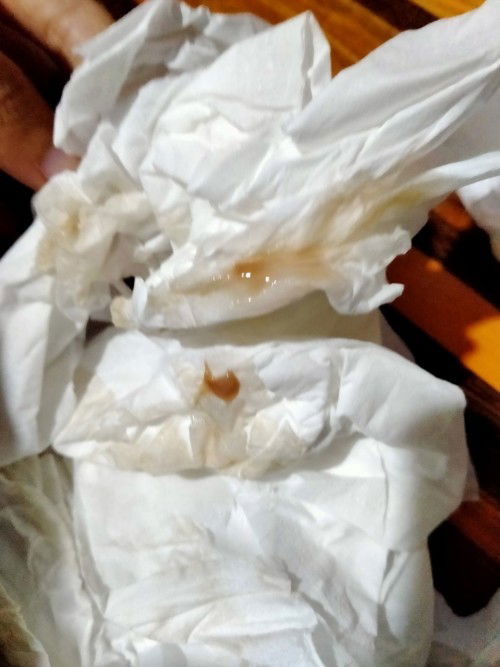 อันตรายไหมค่ะ!!