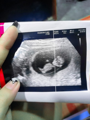 เจอตัวน้องแล้ว