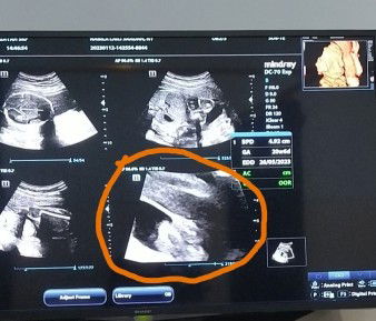 Hasil usg jenis kelamin