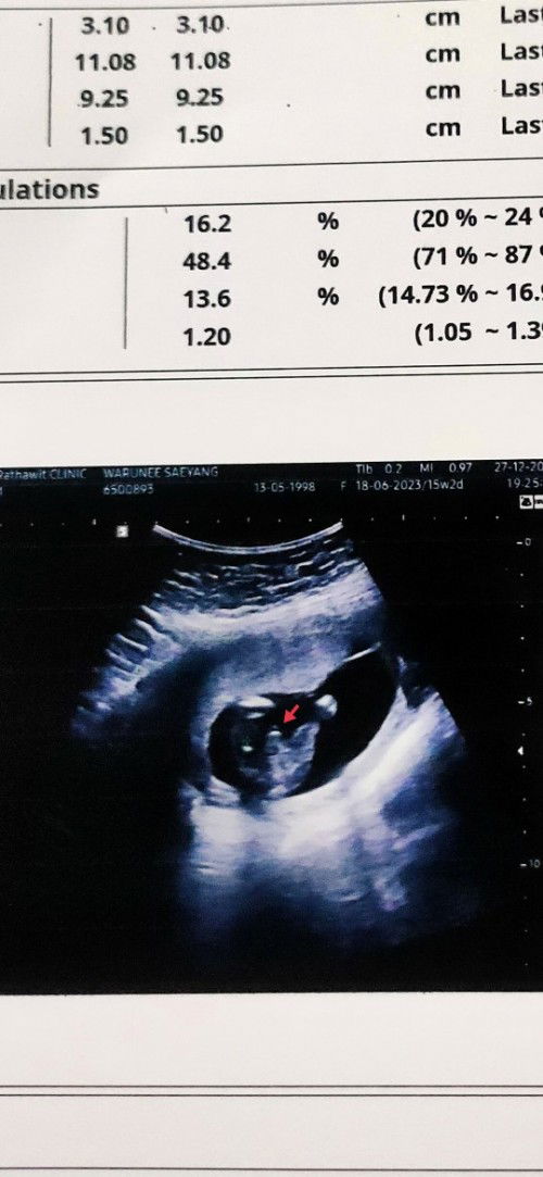 ซาวด์เพศลูก