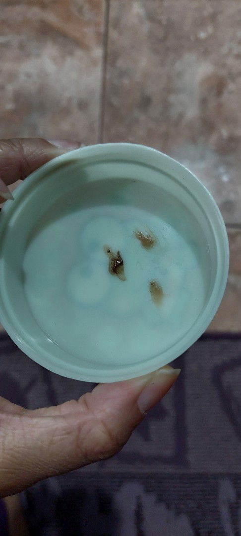 keluar cairan kental kecoklatan saat kehamilan 8 minggu