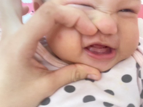 สอบถามแม่ๆหน่อยคะอาการฟันซี่แรกจะขึ้นมีอาการยังไงบ้างคะแบบนี้ใช้มั้ยคะ