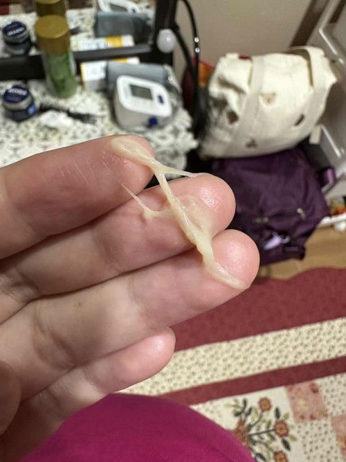 Ni tanda tanda ataupun kesan seluk? Due date 19/1